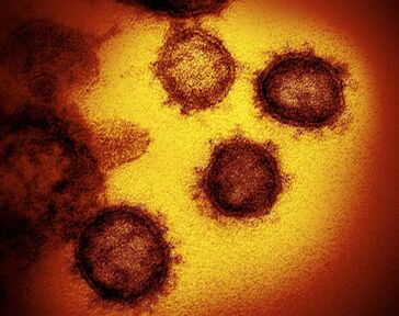 SARS-CoV with coronaFragment.jpg